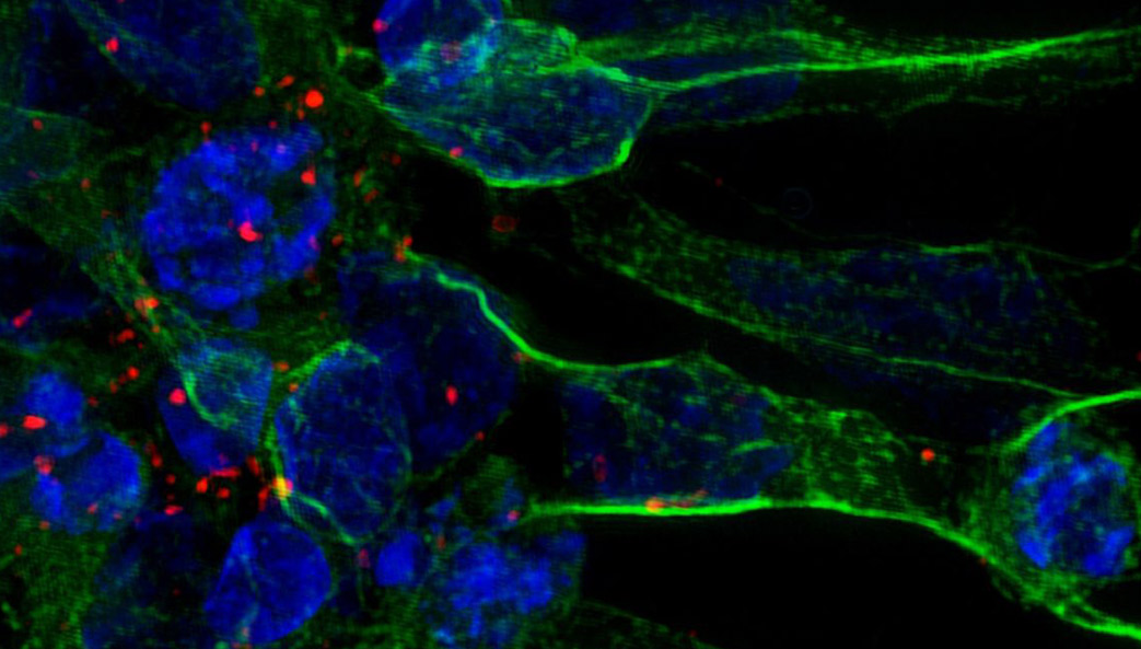 image of exosomes and neurons